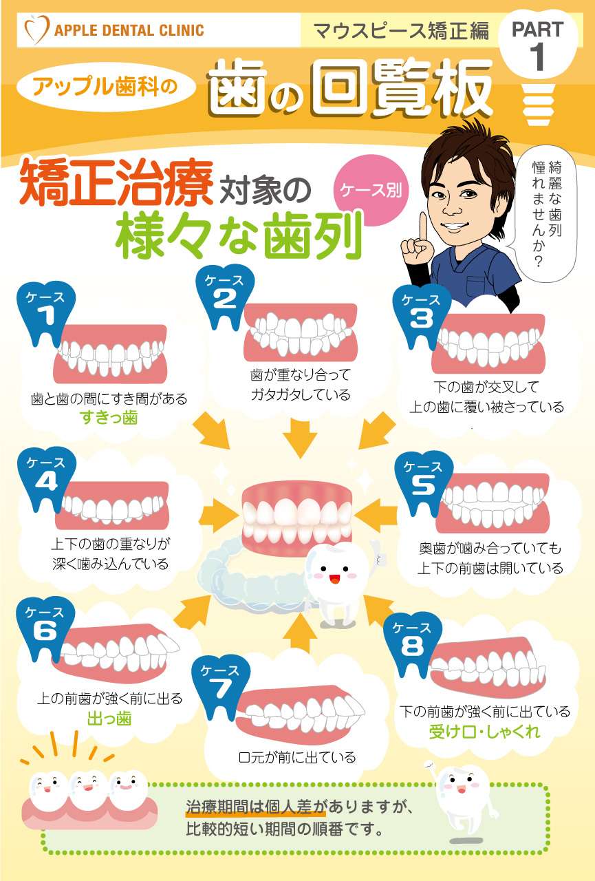 歯の回覧板矯正編