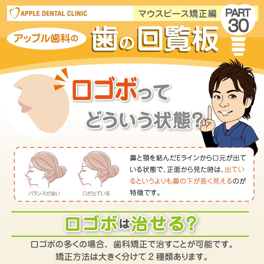 歯の回覧板 矯正編 No30