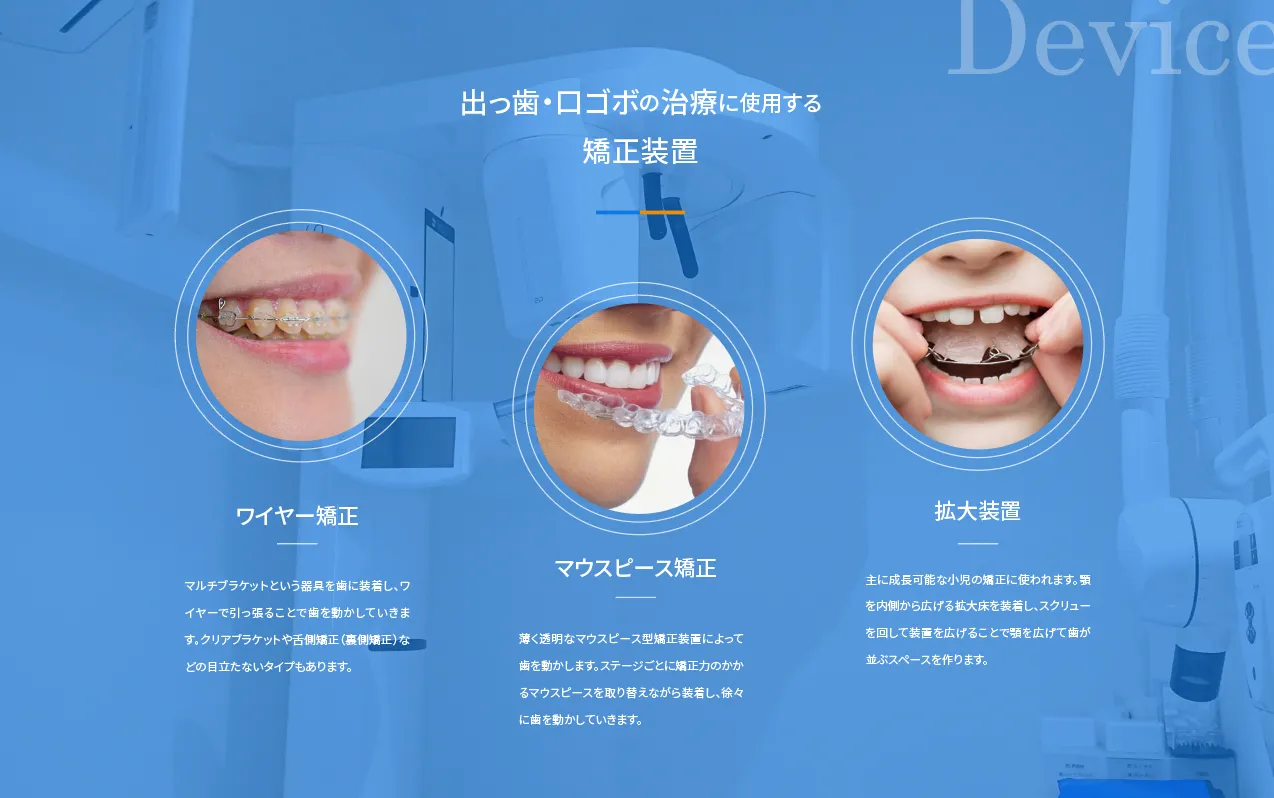 出っ歯・口ゴボの治療に使用する矯正装置