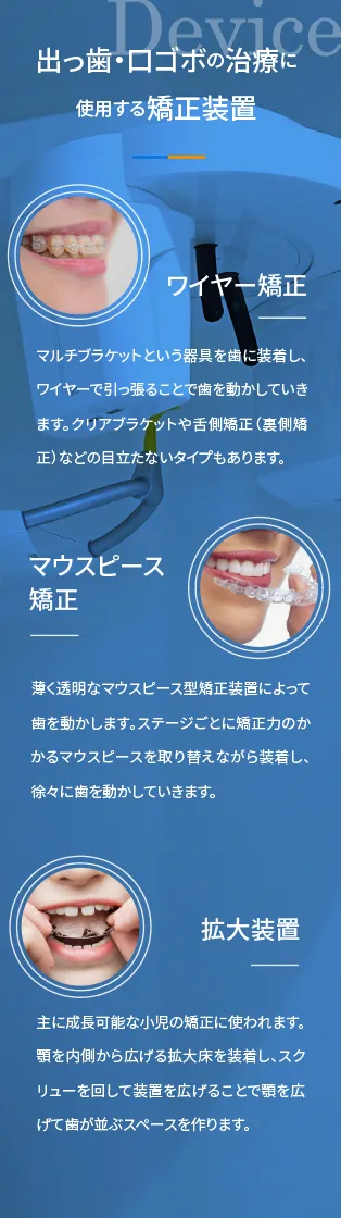 出っ歯・口ゴボの治療に使用する矯正装置