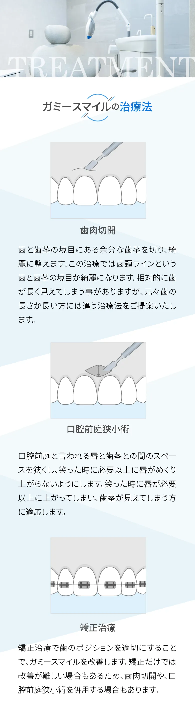 ガミースマイルの治療法