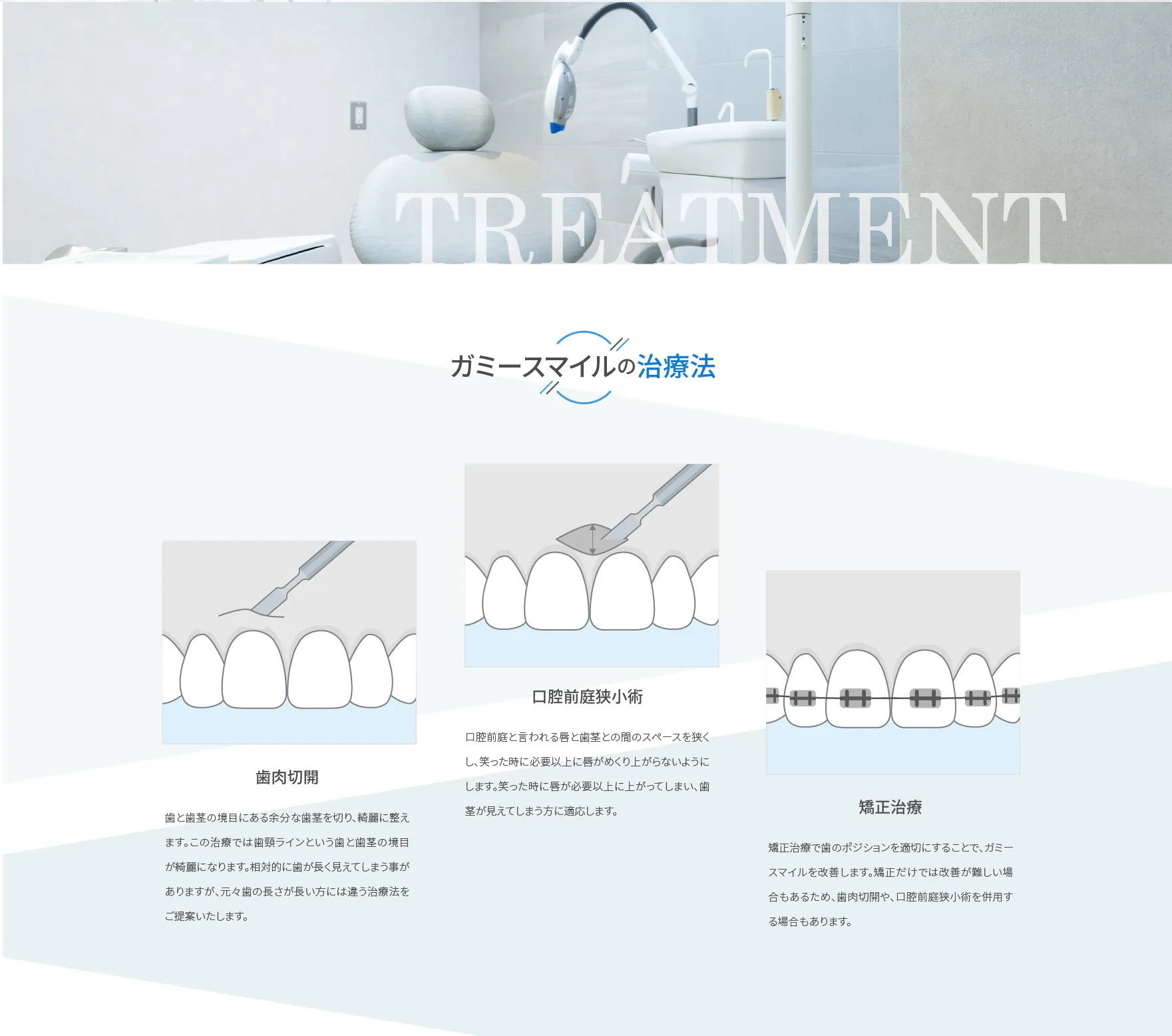 ガミースマイルの治療法