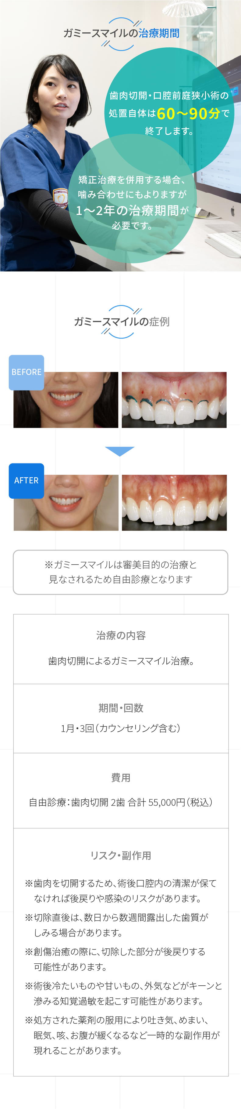 ガミースマイルの治療期間と症例