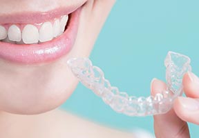 マウスピース型矯正装置のイメージ