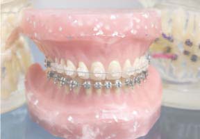 マルチブラケット装置の模型