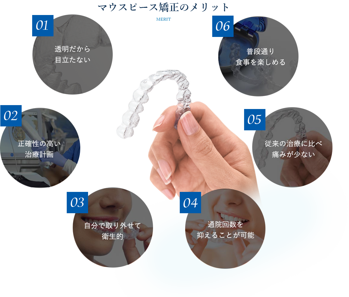 マウスピース矯正のメリット