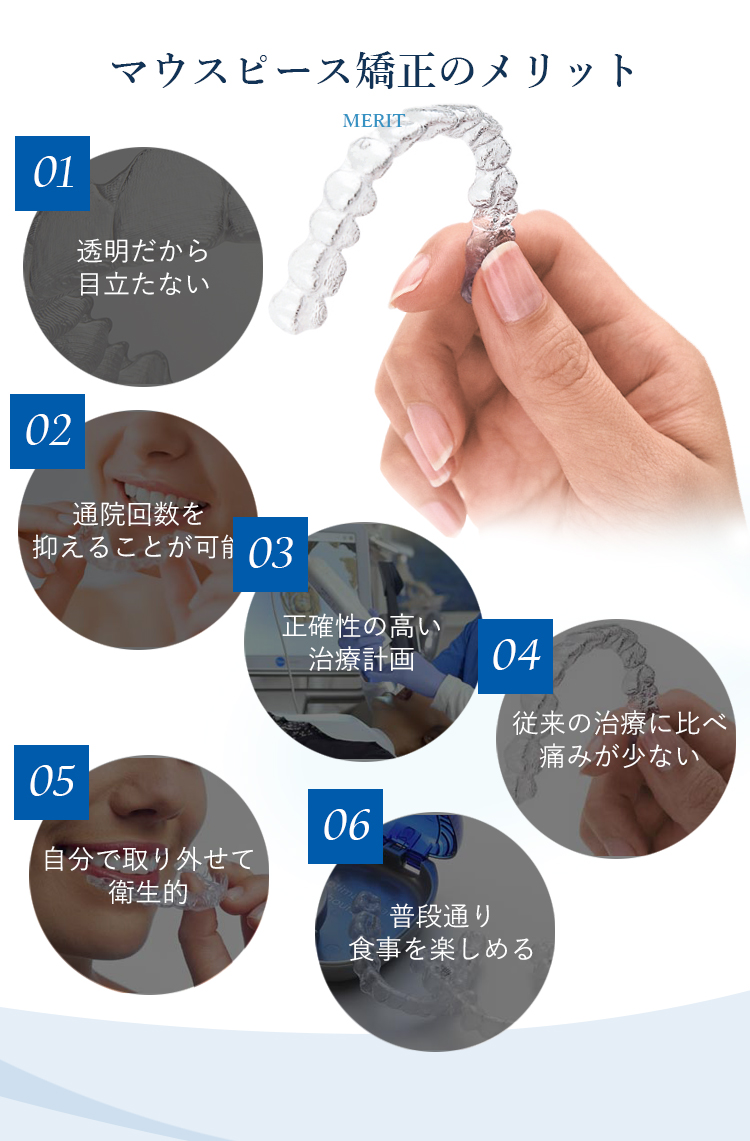 マウスピース矯正のメリット